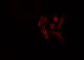 GB5 / GNB5 Antibody
