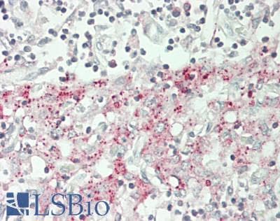 IHC-plus™ Polyclonal Rabbit anti-Human SLC25A11 Antibody (Internal, IHC, WB)
