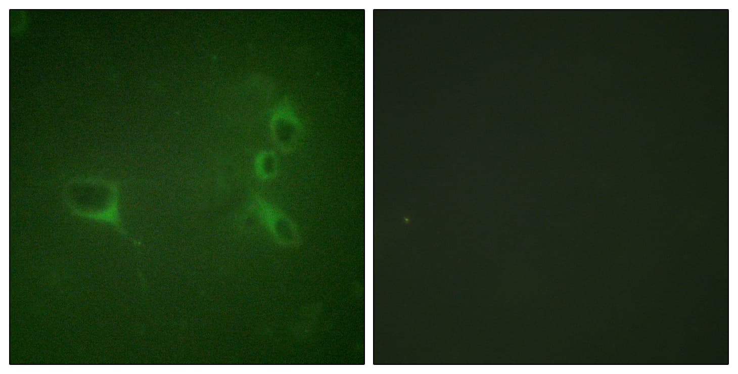 CML / BCR Antibody (phospho-Tyr360)