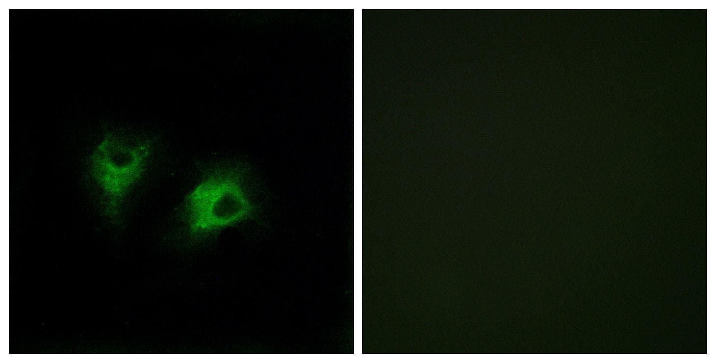Polyclonal Rabbit anti-Human CELSR2 Antibody (IHC, IF)