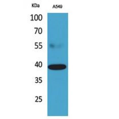 CGR19 / CGRRF1 Antibody (C-terminal)