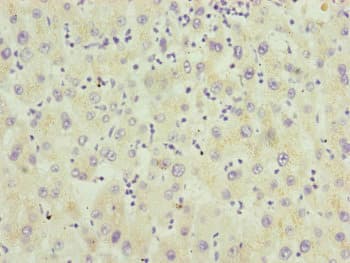 Polyclonal Rabbit anti-Human RMA1 / RNF5 Antibody (IHC, WB)