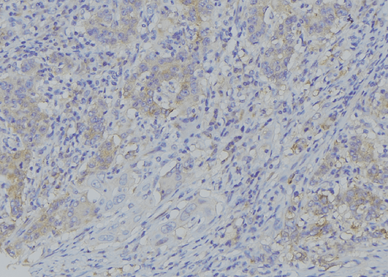 PDP2 Antibody