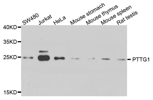 IHC-plus™ Polyclonal Rabbit anti-Human Securin / PTTG1 Antibody (IHC, WB)