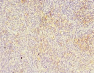 Polyclonal Rabbit anti-Human LITAF Antibody (IHC, WB)