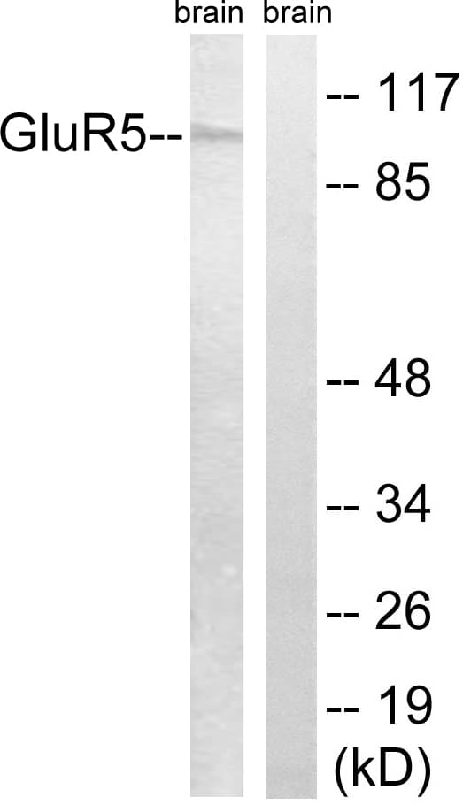 GRIK1 / GLUR5 Antibody (aa10-59)