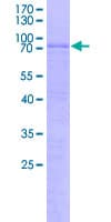 Human DUX4 Protein (Recombinant GST)