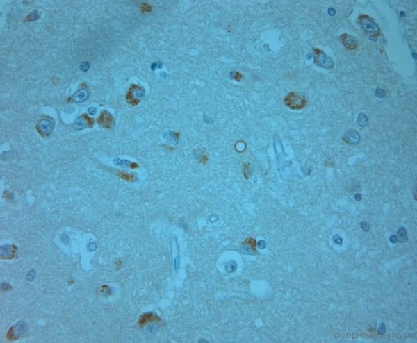 Polyclonal Rabbit anti-Human ERK1 + ERK2 Antibody (phospho-Thr202/Tyr204, IHC, WB)
