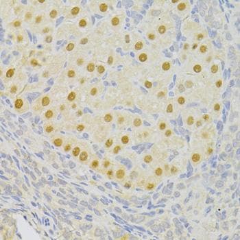 Polyclonal Rabbit anti-Human PFK2 / PFKFB3 Antibody (IHC)