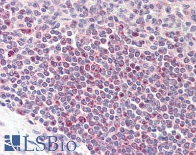 IHC-plus™ PRR11 Antibody