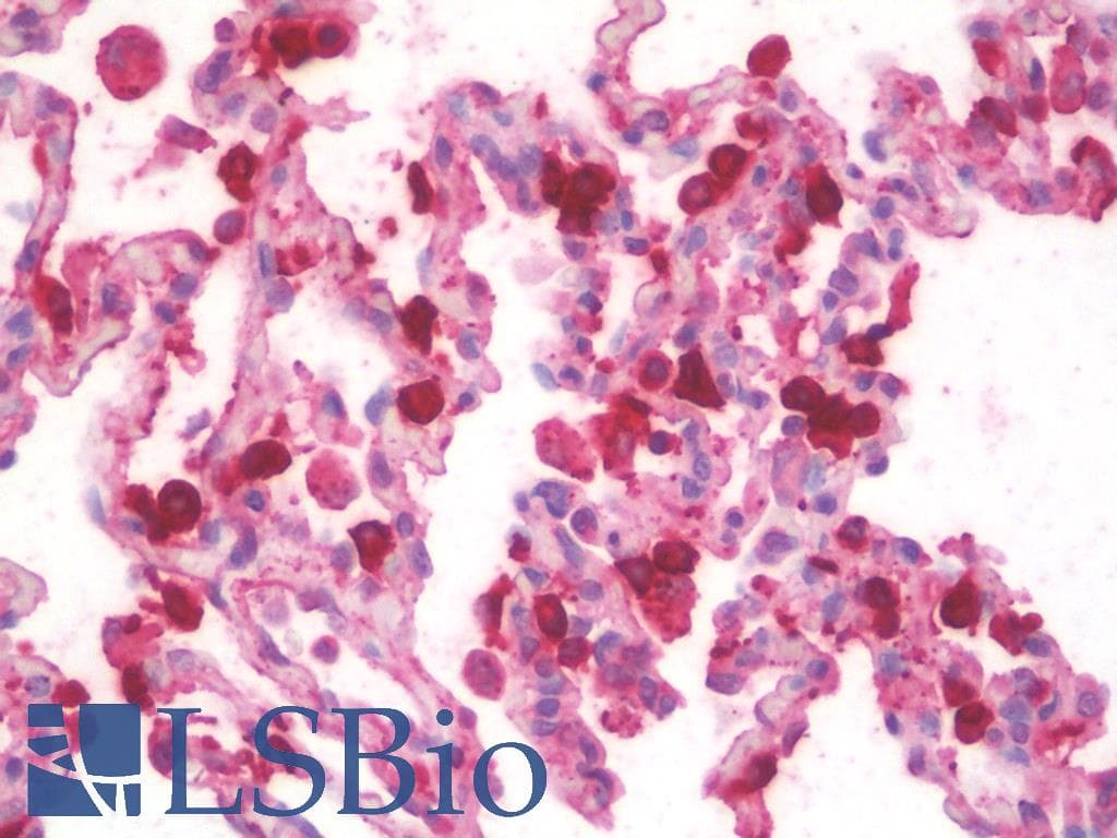 IHC-plus™ Polyclonal Goat anti-Human SFTPA1 + SFTPA2 Antibody (aa102-115, IHC, WB)