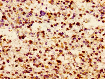 Polyclonal Rabbit anti-Human JAM3 Antibody (IHC, WB)
