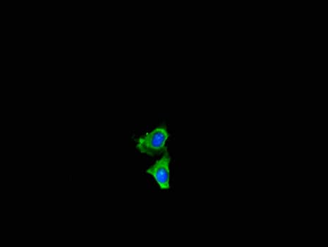 NF2 / Merlin Antibody