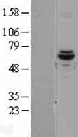 ACAD9 Protein (Over-Expression Lysate Myc-DDK (Flag))