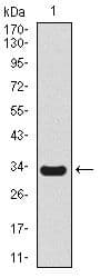 Monoclonal Mouse anti-Human SCGB1A1 / Uteroglobin Antibody (clone 3A8B8, Amino Acid: 26-91, WB)