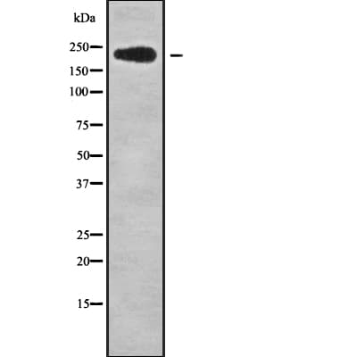 Polyclonal Rabbit anti-Human NUP214 / CAN Antibody (WB)