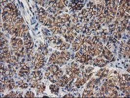 CTNNB1 / Beta Catenin Antibody (clone OTI12H7)
