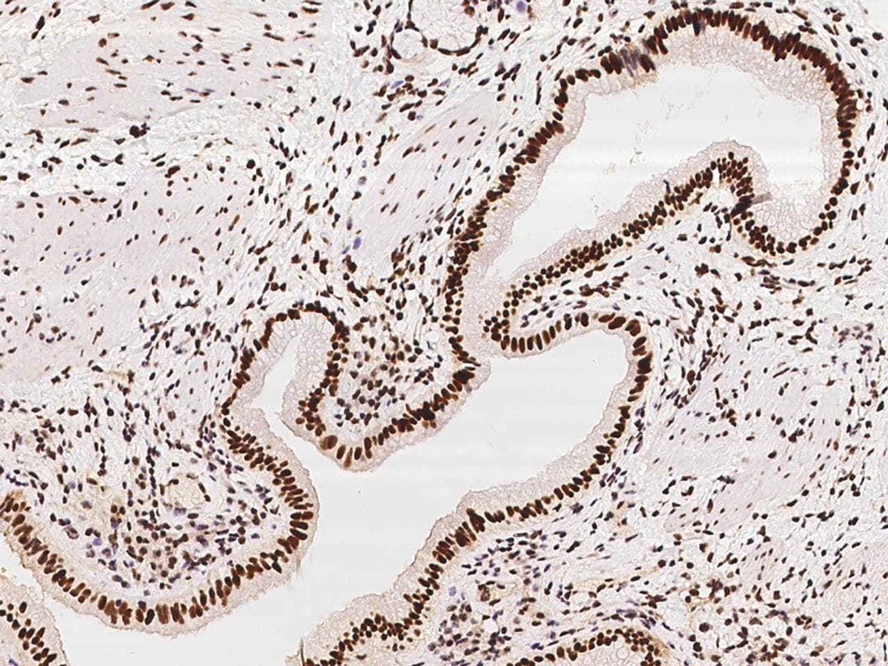 Polyclonal Rabbit anti-Human SP100 Antibody (IHC, IF)