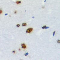 Polyclonal Rabbit anti-Human ZNF668 Antibody (Internal, IHC, IF, WB)