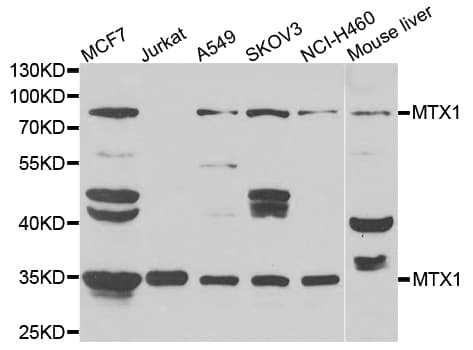 IHC-plus™ MTX1 / Metaxin 1 Antibody