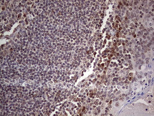 C14orf166 Antibody (clone OTI3F4)