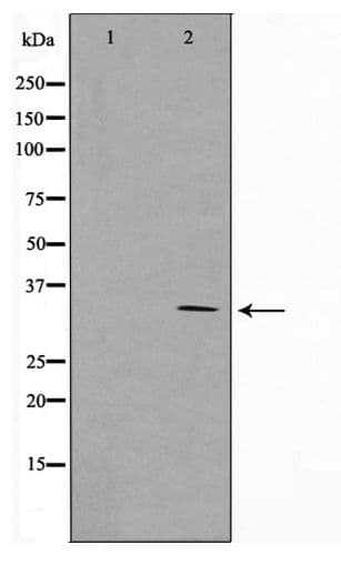 RNF144A / RNF144 Antibody