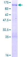 Human IFI16 Protein (Recombinant GST)