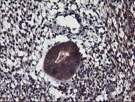 ALG2 Antibody (clone OTI3C2, Carrier-free)
