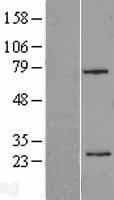 CSN2 / Beta Casein Protein (Over-Expression Lysate Myc-DDK (Flag))