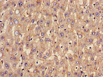 SLC20A1 Antibody