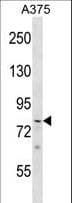 PHF21A / BHC80 Antibody (aa436-464)