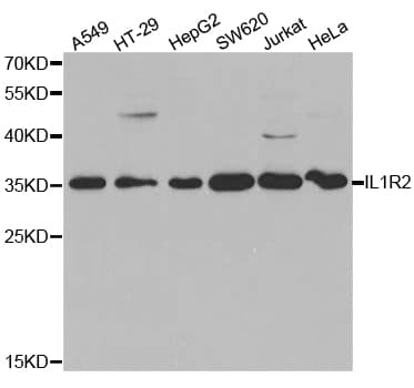 Polyclonal Rabbit anti-Human CD121b / IL1R2 Antibody (IHC, WB)