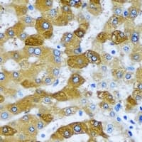 SCAD / ACADS Antibody