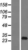 Human IFNA14 / Interferon Alpha 14 Protein (Over-Expression Lysate Myc-DDK (Flag))