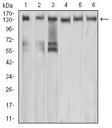 Monoclonal Mouse anti-Human c-Met Antibody (clone 5E9C4, IHC, IF, WB)
