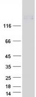 Human ADGRA2 / GPR124 Protein (Recombinant Myc-DDK (Flag))