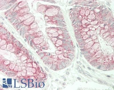 IHC-plus™ PMP70 Antibody (N-Terminus)