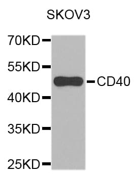 Polyclonal Rabbit anti-Human CD40 Antibody (IHC, WB)