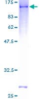 Human DDX1 Protein (Recombinant GST)