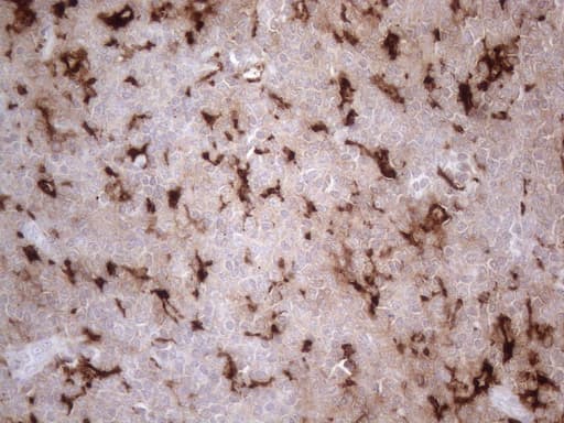 GPNMB / Osteoactivin Antibody (clone OTI2F9)