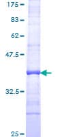 Human HBA1 Protein (Recombinant GST, N-terminus)