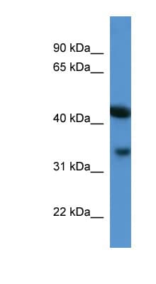 Polyclonal Rabbit anti-Mouse ADAP1 / CENTA1 Antibody (aa228-277, WB)