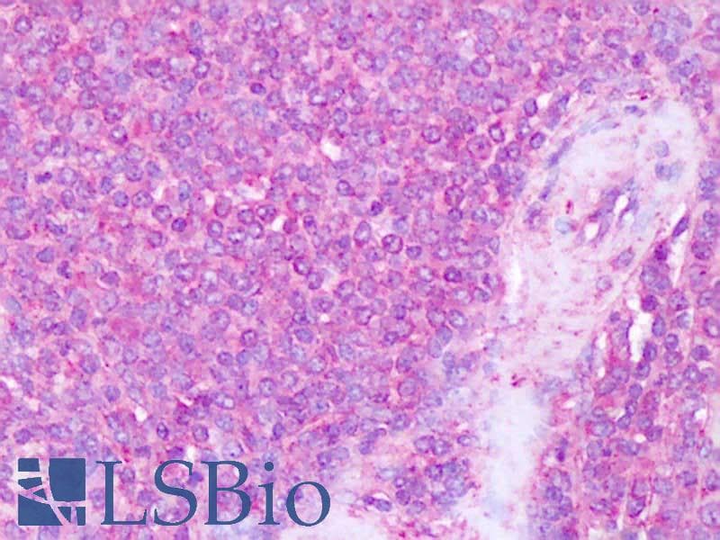 IHC-plus™ ITGA4 / VLA-4 / CD49d Antibody (Internal)