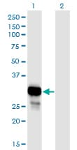 Monoclonal Mouse anti-Human PNP / Nucleoside Phosphorylase Antibody (clone 6E5, WB)