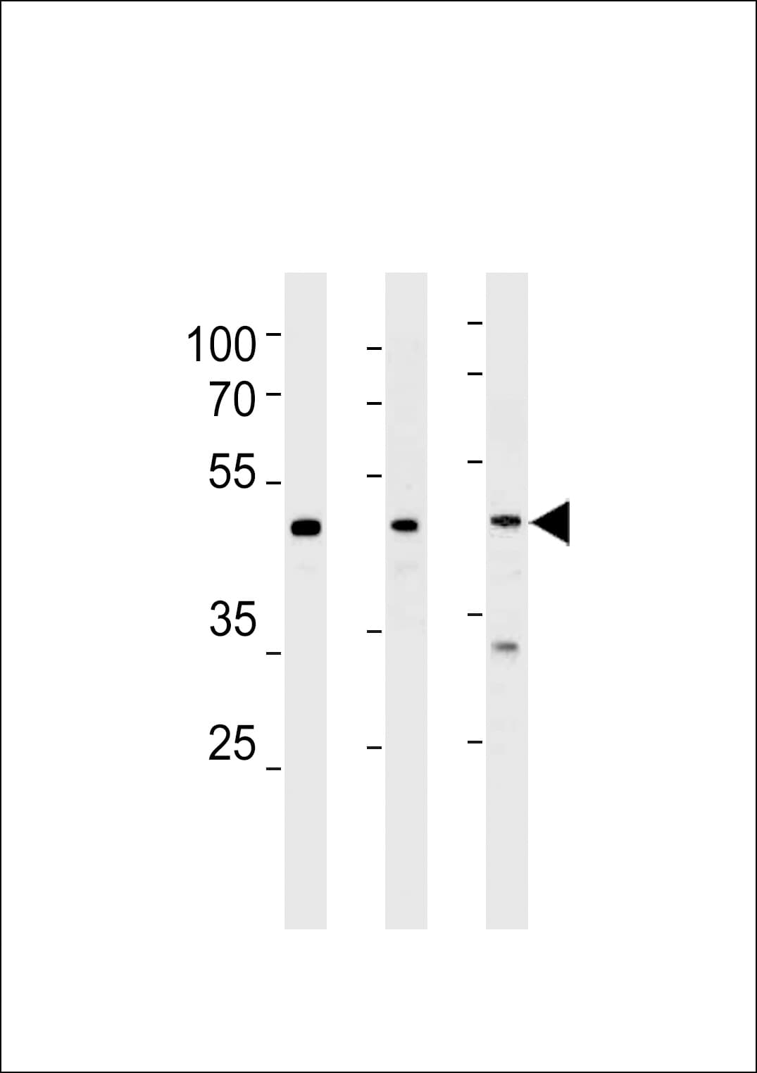 NR0B1 / DAX1 Antibody (aa4-34)