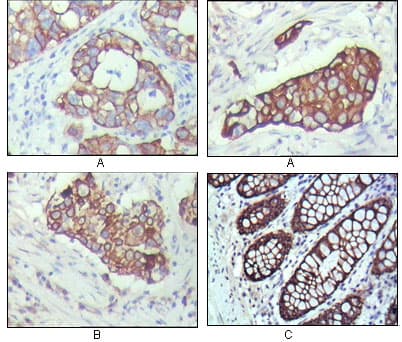 KRT19 / CK19 / Cytokeratin 19 Antibody (clone 9H8G6)