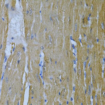 AK1 / Adenylate Kinase 1 Antibody
