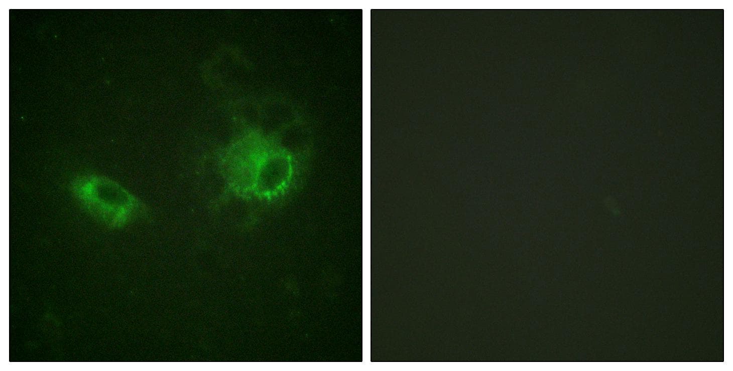 PDGFRB / PDGFR Beta Antibody