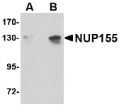 NUP155 Antibody