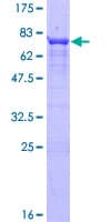 Human PPP2R5E Protein (Recombinant GST)
